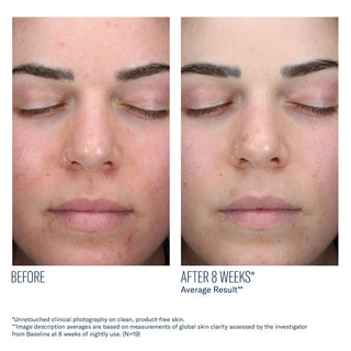 AlphaRet Clearing Serum