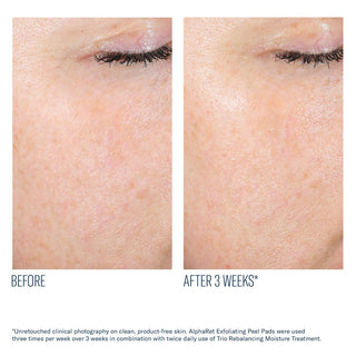 AlphaRet Exfoliating Peel Pads