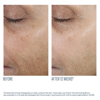Even Skin Tone Correcting Serum