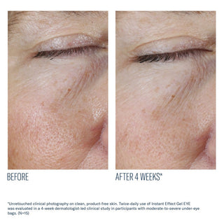 Instant Effect Gel EYE