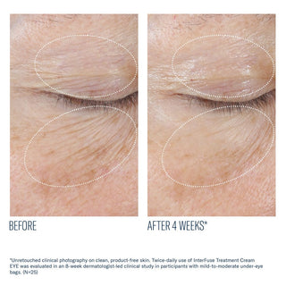 InterFuse Treatment Cream EYE