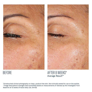 EyeMax AlphaRet Overnight Cream