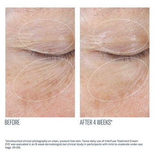 InterFuse Treatment Cream EYE