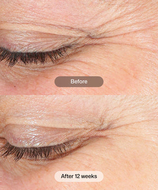 Revox™ Line Relaxer